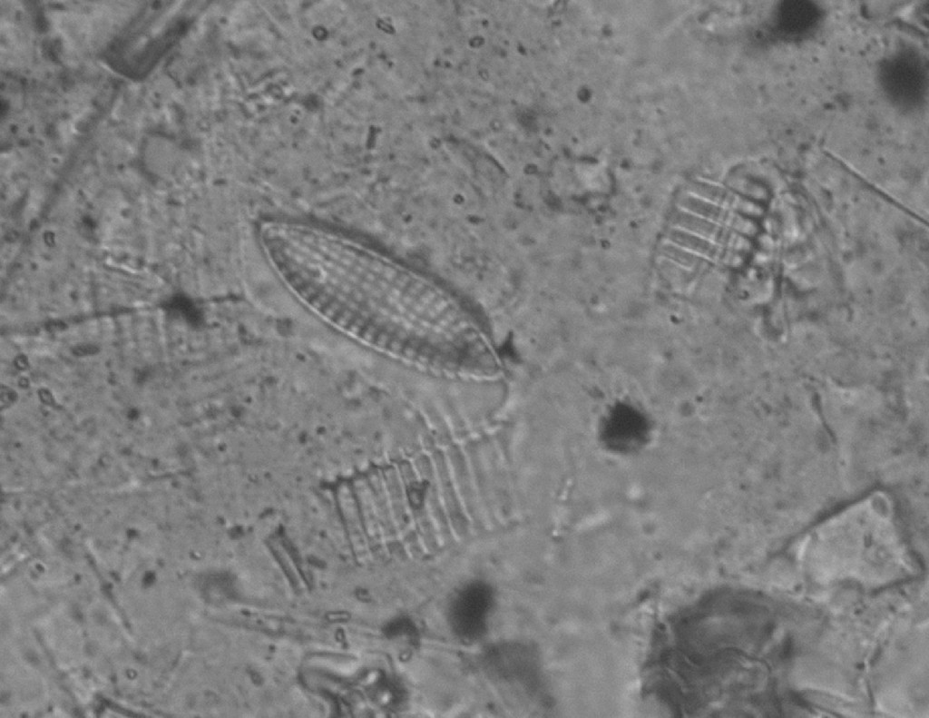 Using a microscope, Cortada captured this photograph this diatom from samples used by scientists at FIU’s Florida Coastal Everglades LTER (Long Term Ecological Research) to study the ecology of the Everglades and sea level rise.  Diatoms are water-bound, single-celled symmetrical organisms encapsulated in silica. This diatom was alive in 1915.  It was generating oxygen on Biscayne Bay as the the Miami Beach incorporators were bringing the city to life.  Cortada used this image to create an art piece that celebrates the city's centennial.